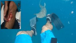 Shark Encounters – Unprovoked Attacks By Sharks